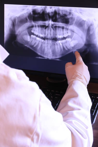 Best Same-Day Emergency Dentist in Boiling Springs, NC