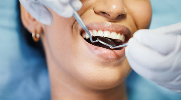 Best Emergency Root Canal Treatment in Boiling Springs, NC