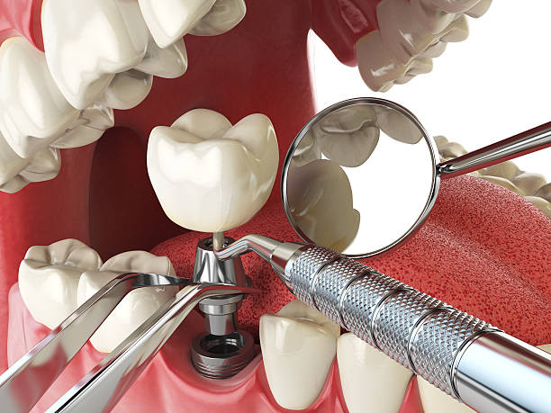 Best Emergency Treatment for Toothache in Boiling Springs, NC